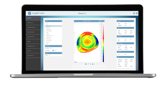 Eye Surface Profiler Online Demonstration